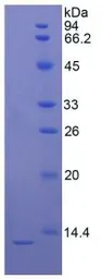 Rat S100 beta protein, His tag. GTX00346-pro