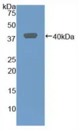 Rat CXCL2 / GRO beta protein, His and GST tag. GTX00351-pro
