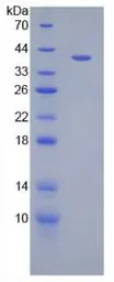 Rat CXCL2 / GRO beta protein, His and GST tag. GTX00351-pro