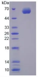 Rat CYP1A1 protein, His and GST tag. GTX00355-pro