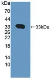 Rat Calpain 1 protein, His tag. GTX00357-pro