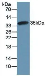 Rat Calpain 1 protein, His tag. GTX00358-pro