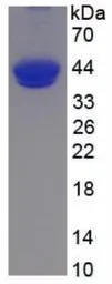 Human C5a protein, His and Fc tag (active). GTX00416-pro