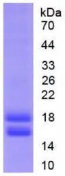Human CYP1B1 protein, His tag. GTX00418-pro