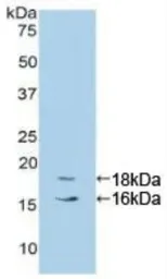 Human CYP1B1 protein, His tag. GTX00418-pro