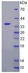 Human Thymidylate synthase protein, His tag. GTX00420-pro