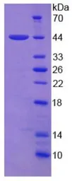 Human Amphiregulin protein, His and GST tag. GTX00421-pro
