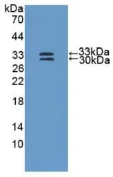 Human SOD3 protein, His tag. GTX00425-pro