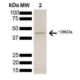 Human AHA-1 protein, His tag (active). GTX00427-pro