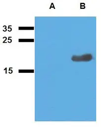 Anti-Mycobacterium tuberculosis Acr2 antibody [PAb (188)] used in Western Blot (WB). GTX00498