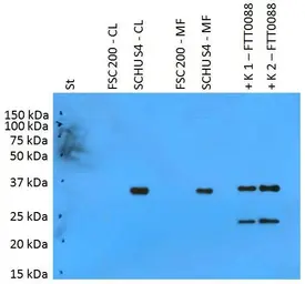 Anti-F. t. tularensis PilT antibody [PAb (180)] used in Western Blot (WB). GTX00502