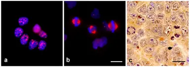 Anti-TPX2 antibody [TPX2-01] used in Immunocytochemistry/ Immunofluorescence (ICC/IF). GTX00510