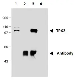 Anti-TPX2 antibody [TPX2-01] used in Immunoprecipitation (IP). GTX00510
