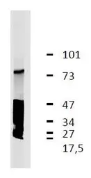 Anti-GARP antibody [GARP5] used in Western Blot (WB). GTX00516