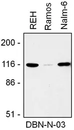 Anti-Drebrin antibody [DBN-N-03] used in Western Blot (WB). GTX00524