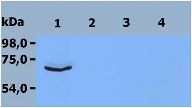 Anti-ZAP70 antibody [ZAP-03] used in Western Blot (WB). GTX00530