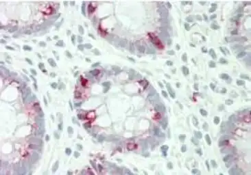 Anti-STYK1 antibody used in IHC (Paraffin sections) (IHC-P). GTX00635