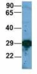 Anti-EIF4E2 antibody used in Western Blot (WB). GTX00636