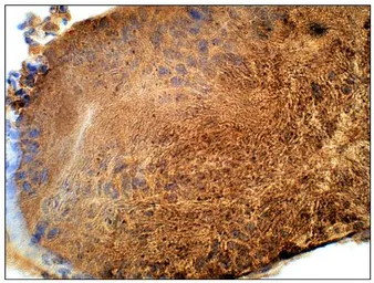 Anti-IL17 Receptor beta antibody used in IHC (Paraffin sections) (IHC-P). GTX00640