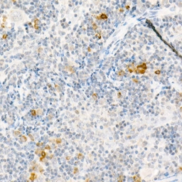 Anti-MCP1 / CCL2 antibody used in IHC (Paraffin sections) (IHC-P). GTX00641