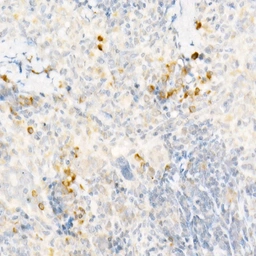 Anti-MCP1 / CCL2 antibody used in IHC (Paraffin sections) (IHC-P). GTX00641