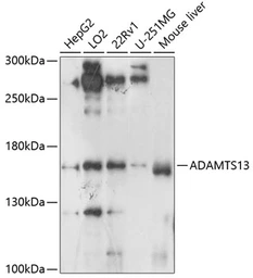 Anti-ADAMTS13 antibody used in Western Blot (WB). GTX00642