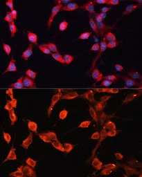 Anti-ADAMTS13 antibody used in Immunocytochemistry/ Immunofluorescence (ICC/IF). GTX00642