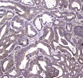 Anti-HtrA1 antibody used in IHC (Paraffin sections) (IHC-P). GTX00643