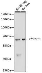 Anti-CYP27B1 antibody used in Western Blot (WB). GTX00645