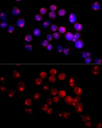 Anti-CYP27B1 antibody used in Immunocytochemistry/ Immunofluorescence (ICC/IF). GTX00645
