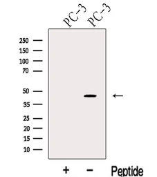 Anti-KLF6 antibody used in Western Blot (WB). GTX00646