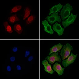 Anti-Nup153 antibody used in Immunocytochemistry/ Immunofluorescence (ICC/IF). GTX00649