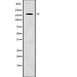 Anti-Nup153 antibody used in Western Blot (WB). GTX00649