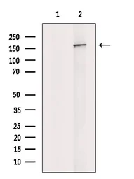 Anti-Nup153 antibody used in Western Blot (WB). GTX00649