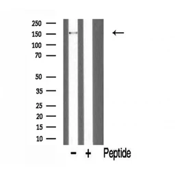 Anti-PARD3 antibody used in Western Blot (WB). GTX00653