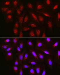 Anti-TET3 antibody used in Immunocytochemistry/ Immunofluorescence (ICC/IF). GTX00657