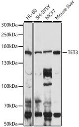 Anti-TET3 antibody used in Western Blot (WB). GTX00657