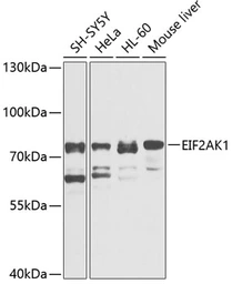 Anti-EIF2AK1 antibody used in Western Blot (WB). GTX00664