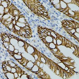 Anti-Claudin 3 antibody used in IHC (Paraffin sections) (IHC-P). GTX00665