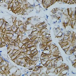 Anti-Claudin 3 antibody used in IHC (Paraffin sections) (IHC-P). GTX00665