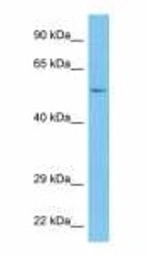 Anti-CMPK2 antibody used in Western Blot (WB). GTX00670