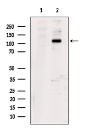 Anti-PERK (phospho Ser555) antibody used in Western Blot (WB). GTX00673