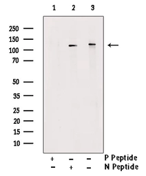 Anti-PERK (phospho Ser555) antibody used in Western Blot (WB). GTX00673