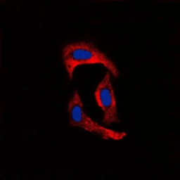 Anti-MMP1 antibody used in Immunocytochemistry/ Immunofluorescence (ICC/IF). GTX00674