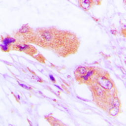 Anti-MMP1 antibody used in IHC (Paraffin sections) (IHC-P). GTX00674