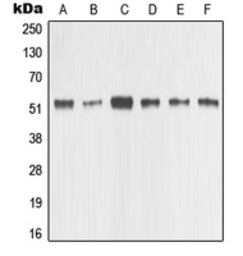 Anti-MMP1 antibody used in Western Blot (WB). GTX00674