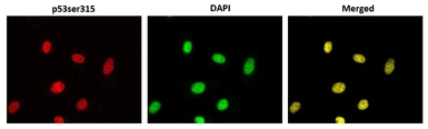 Anti-p53 (phospho Ser315) antibody [#18] used in Immunocytochemistry/ Immunofluorescence (ICC/IF). GTX00678
