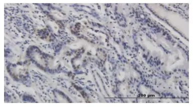 Anti-p53 (phospho Ser315) antibody [#18] used in IHC (Paraffin sections) (IHC-P). GTX00678