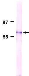 Anti-Nucleoporin p62 antibody [2A11] used in Western Blot (WB). GTX00696