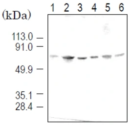 Anti-KPNA4 antibody [3D10] used in Western Blot (WB). GTX00698
